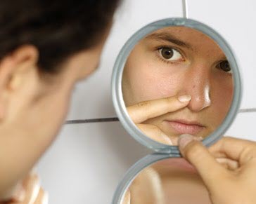 how to get rid of dark spots