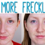 How to get rid of freckles on the skin