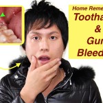 How to get rid of a toothache