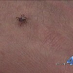 HOW TO BRUSH OFF TICKS FROM YOUR BODY