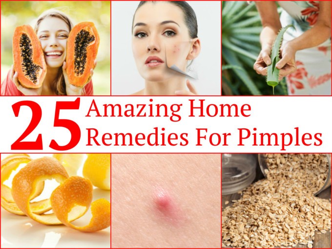 home-remedies-for-pimples